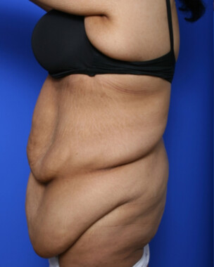 Case # 8 before photo