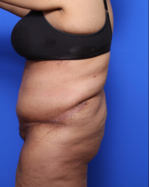 Case # 8 after photo