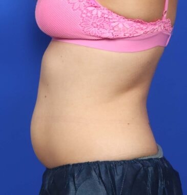 Case # 20 before photo