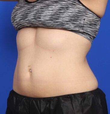 Case # 20 after photo