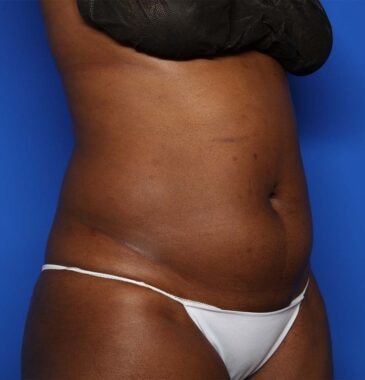 Case # 22 before photo