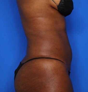 Case # 22 after photo