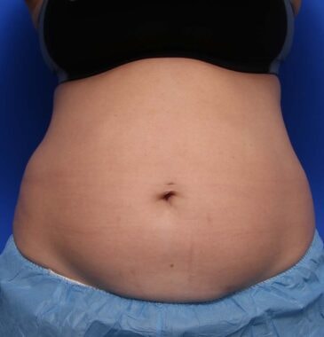 Case # 24 before photo