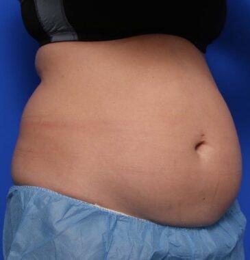 Case # 24 before photo