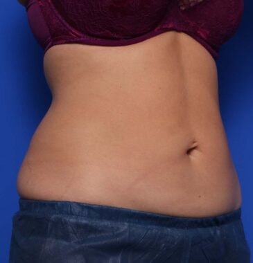 Case # 24 after photo