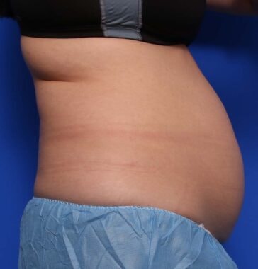 Case # 24 before photo