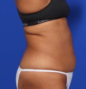 Case # 21 before photo