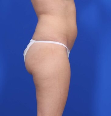 Case # 25 after photo