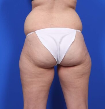 Case # 25 before photo