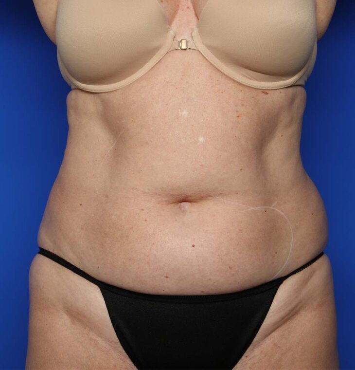 Case # 26 before photo