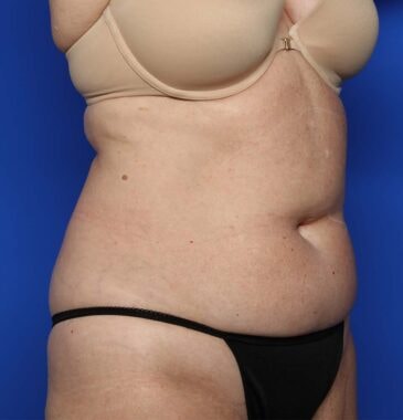 Case # 26 before photo