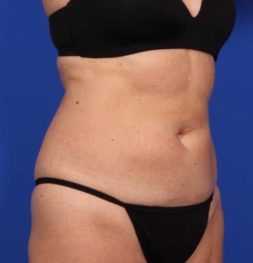 Case # 26 after photo