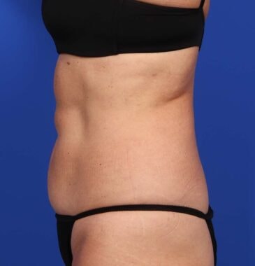 Case # 26 after photo