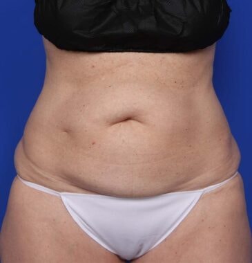 Case # 27 before photo