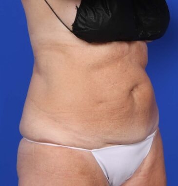 Case # 27 after photo