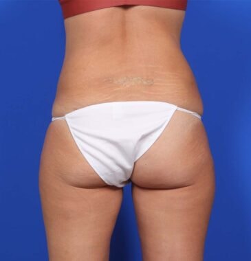 Case # 29 after photo