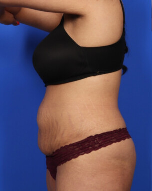 Case # 122 before photo