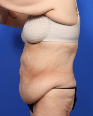 Case # 9 before photo