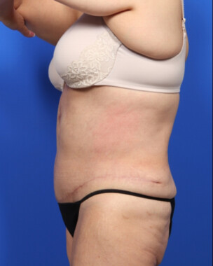 Case # 9 after photo