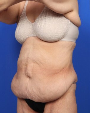 Case # 9 before photo