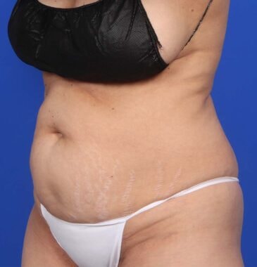 Case # 1 before photo