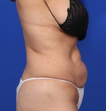 Case # 1 after photo