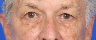 Case # 12 before photo