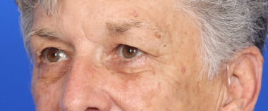 Case # 12 before photo