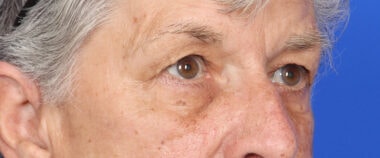 Case # 12 before photo