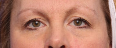 Case # 13 before photo