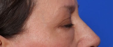 Case # 15 before photo