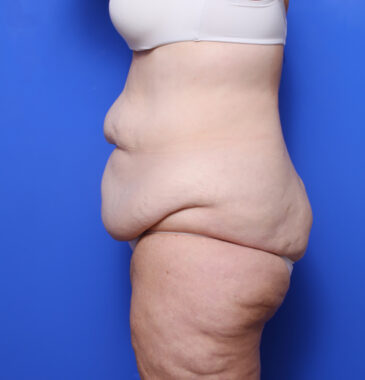 Case # 1 before photo