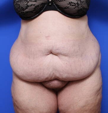 Case # 2 before photo