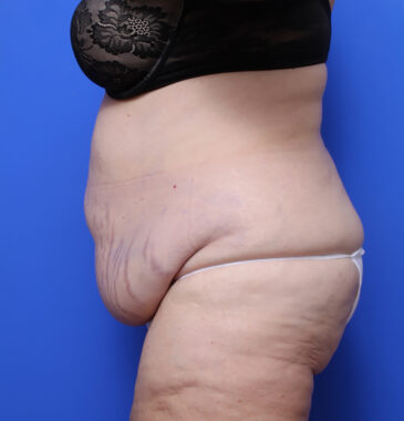 Case # 2 before photo