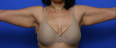 Case # 2 before photo