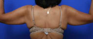 Case # 2 before photo