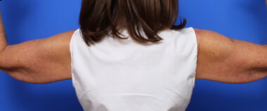 Case # 4 before photo