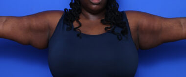 Case # 5 before photo