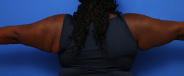 Case # 5 before photo