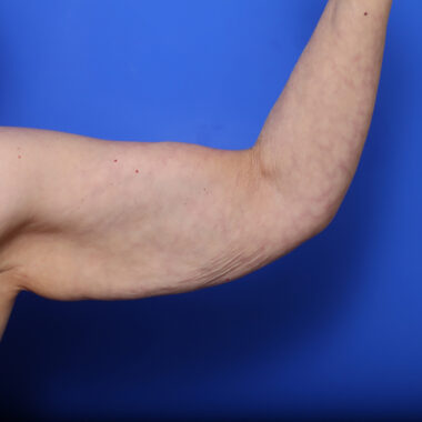 Case # 6 before photo