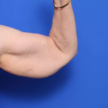 Case # 7 before photo