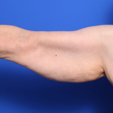 Case # 7 before photo