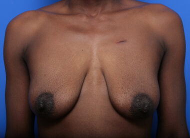 Case # 5 before photo