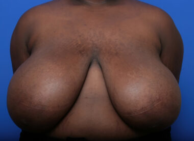 Case # 7 before photo