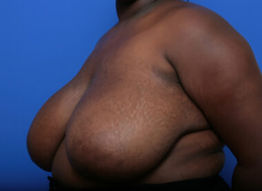 Case # 7 before photo