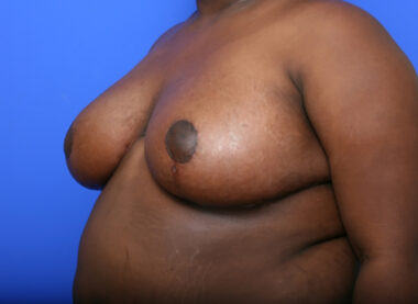 Case # 7 after photo