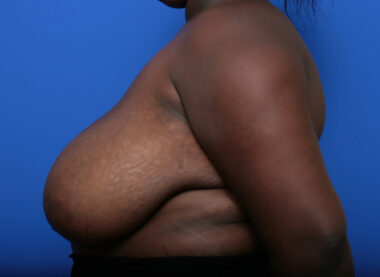 Case # 7 before photo