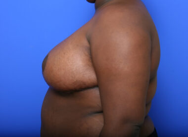 Case # 7 after photo