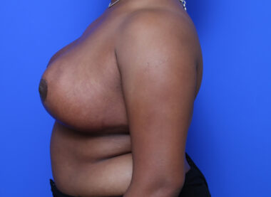 Case # 18 after photo