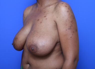 Case # 19 before photo